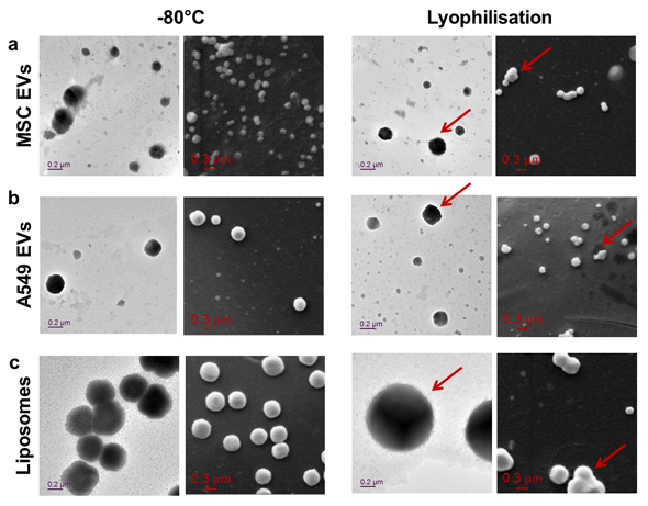 Elektronenmikroskopische Bilder von extrazellulären Vesikeln (EVs) isoliert von verschiedenen Zelltypen. EVs wurden bei -80°C oder nach Gefriertrocknung untersucht, hinsichtlich ihrer Oberflächenbeschaffenheit und Größe. 