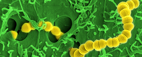 Streptococcus pyogenes löst am häufigsten nekrotisierende Fasziitis aus. 