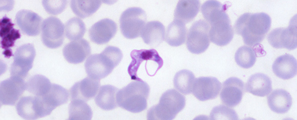 Parasit Trypanosoma cruzi