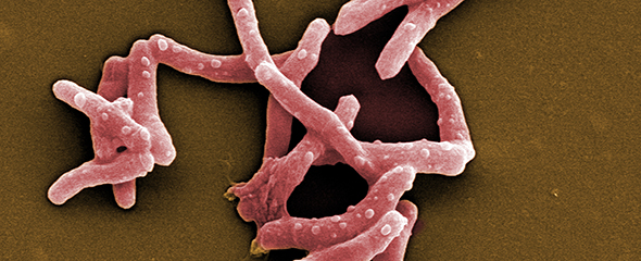 Rasterelektronenmikroskopische Aufnahme von Mycobacterium tuberculosis