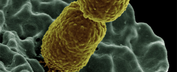 Bakterium Klebsiella pneumoniae