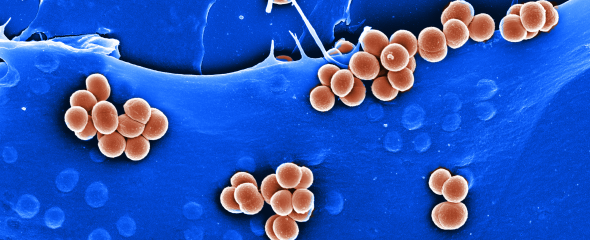 Elektronenmikroskopische Aufnahme von Staphylokokken auf HeLa-Zellen. 