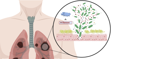 Die entwickelten Pathoblocker inaktivieren das Enzym LasB und entwaffnen somit den Krankheitserreger Pseudomonas aeruginosa. 