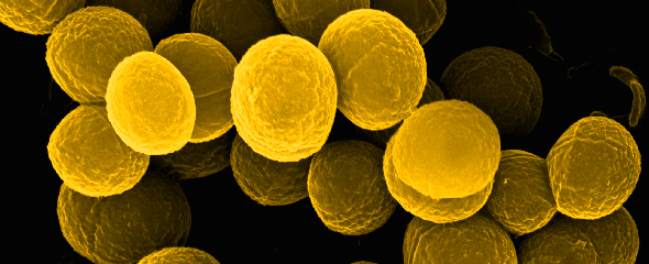 Elektronenmikroskopische Aufnahme von Staphylococcus aureus 