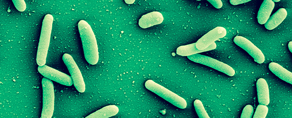 Bakterien der Art Pseudomonas aeruginosa sind äußerst widerstandfähig und kommen fast überall vor. 