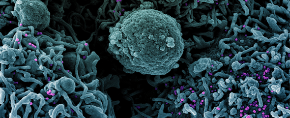 Eingefärbtes Rasterelektronenmikroskopbild einer Zelle 