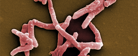 Rasterelektronenmikroskopische Aufnahme von Mycobacterium tuberculosis