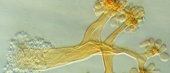 Fruchtkörper von Myxobakterien unter dem Lichtmikroskop 