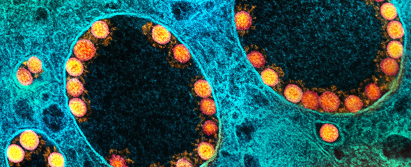 Bild einer infizierten Zelle der Riechschleimhaut