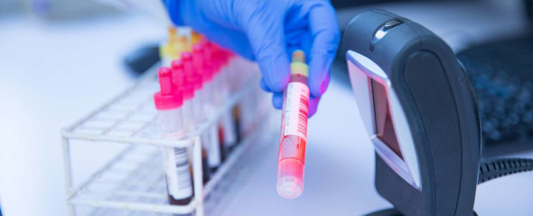 Blood samples