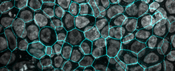 Fluoreszenzfärbung von Arlo-Zellen