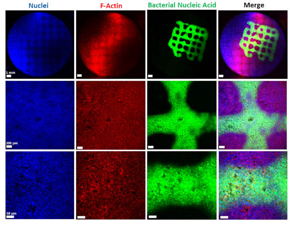 Fluoreszenzmikroskopische Aufnahme von auf Lungenepithelzellen gedruckten Biofilmen