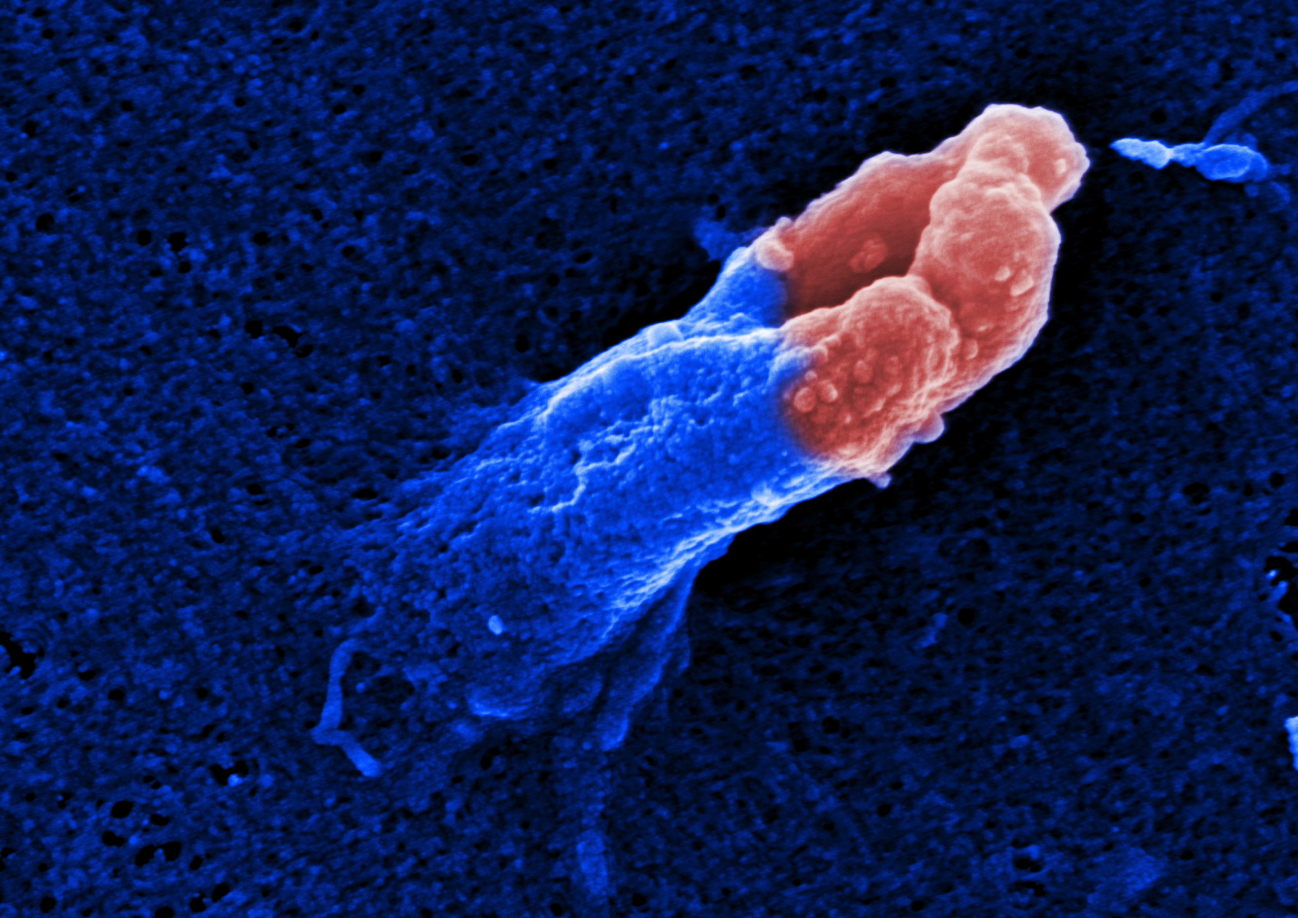 Electron micrograph of M. tuberculosis